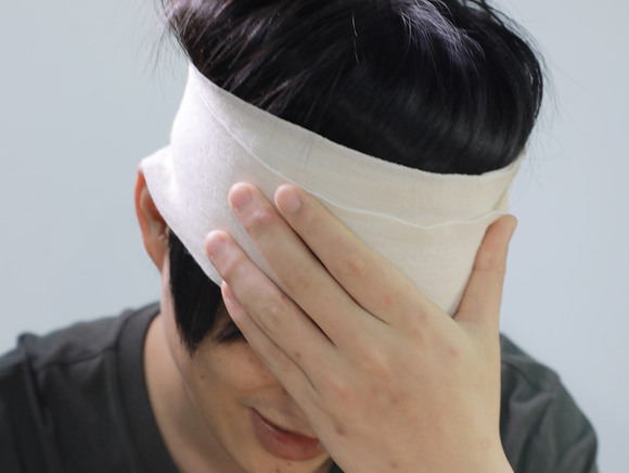 头上骨折轻微伤怎么赔偿多少钱