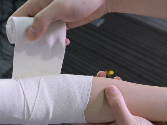 打架擦破点皮会拘留吗