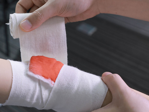 被打了伤情鉴定什么时候做合适